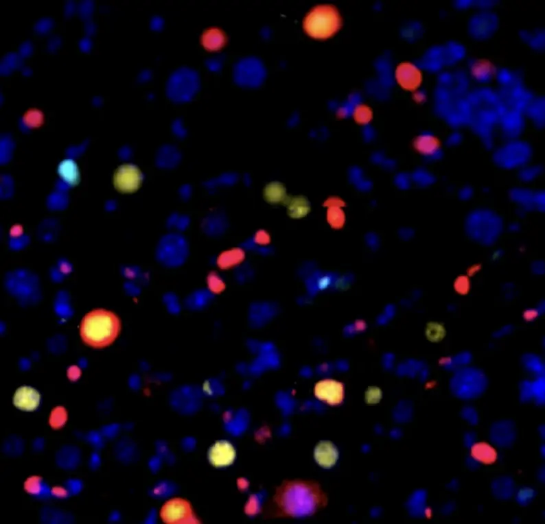 Aged mouse liver cells also featured a progressive increase in the expression of genes related to the release of inflammatory molecules. Image credit: Peter Adams, Adarsh Rajesh, Sanford Burnham Prebys.
