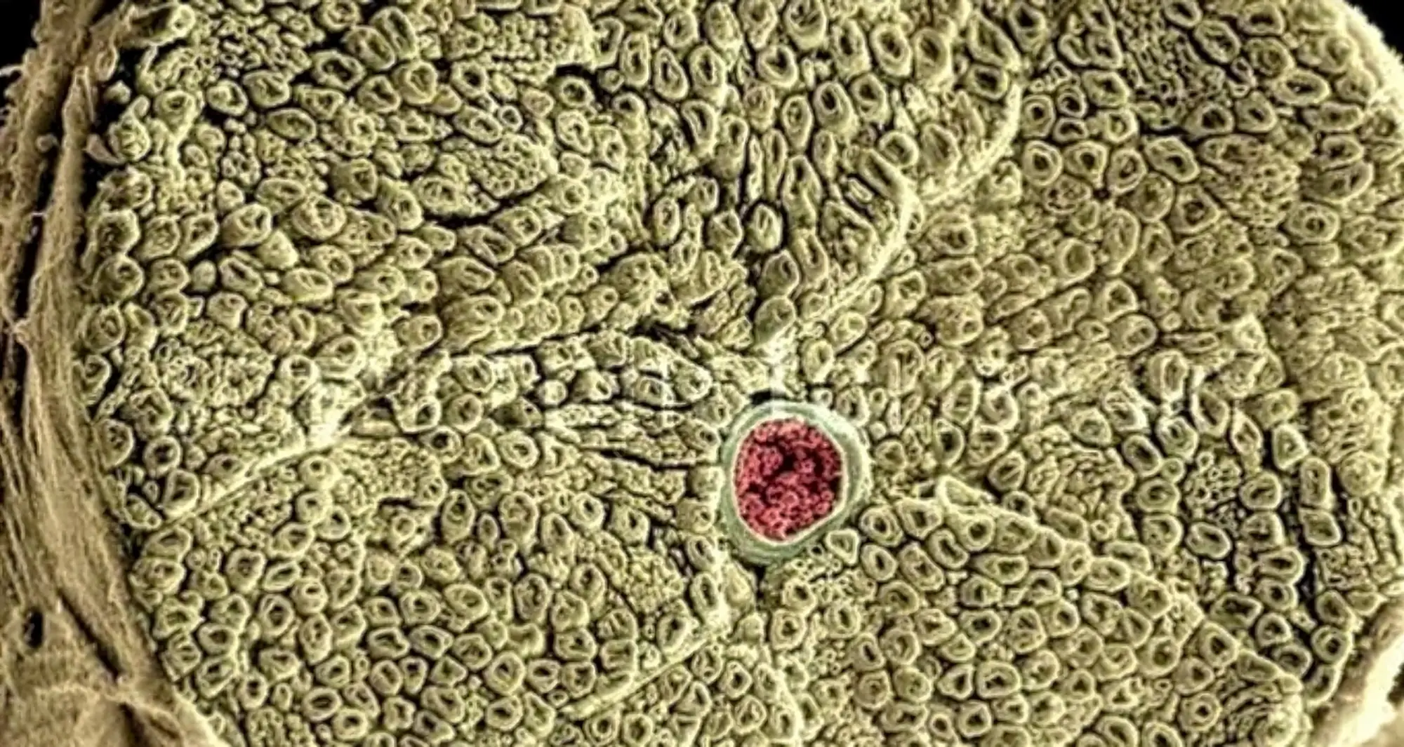 human spinal cord and dorsal root ganglia