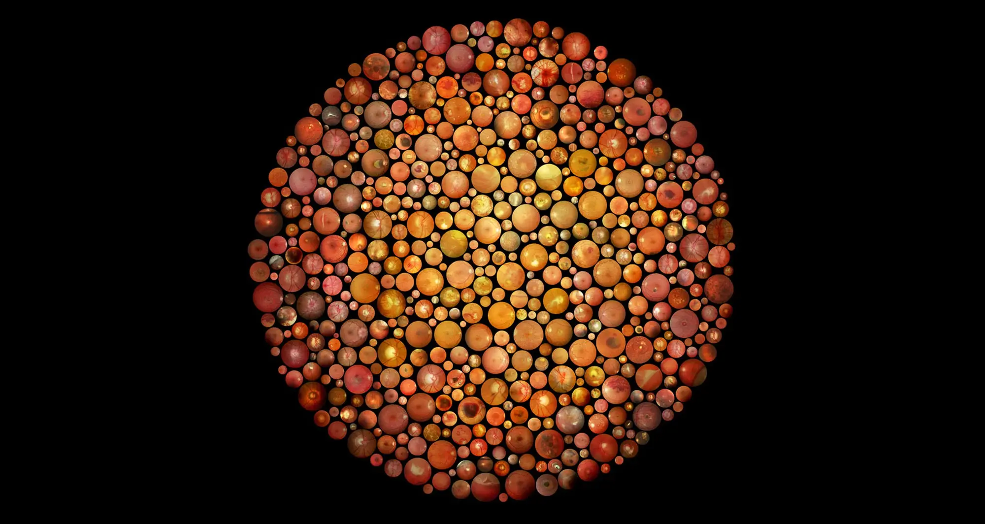 artistic rendition of an Ishihara pattern comprised of more than 500 photographs of people’s retinas. Image courtesy of Jonathan Brett