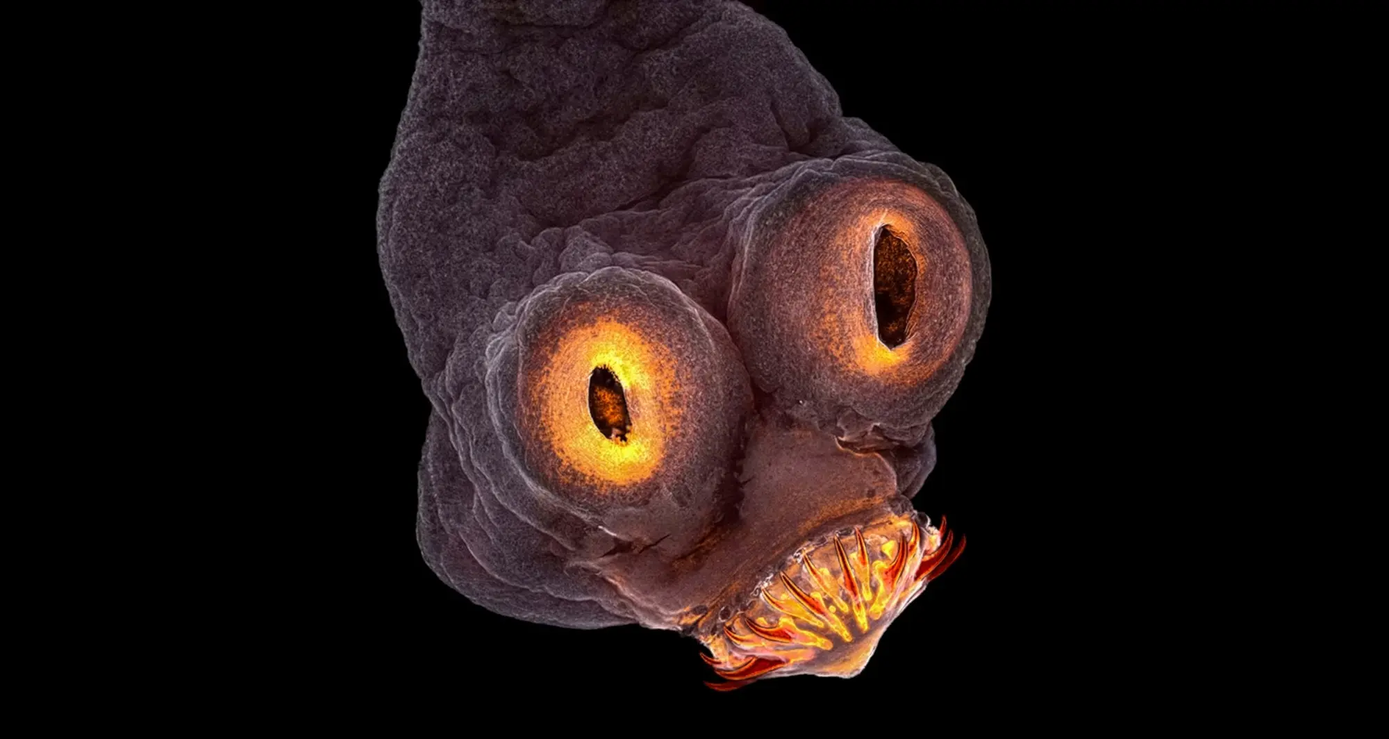 Taenia solium. Image courtesy of Teresa A. Zgoda.