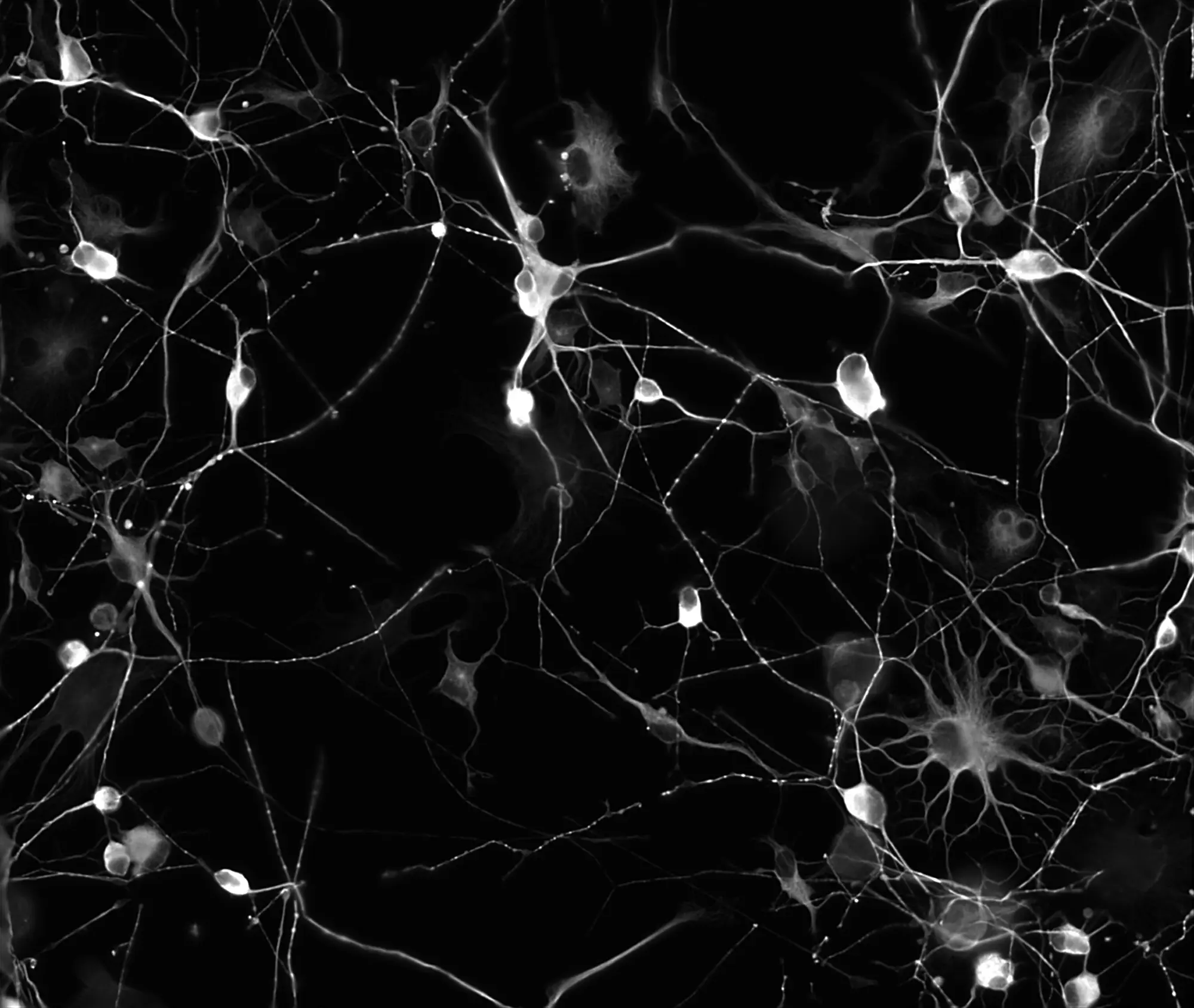 The scientists expanded the number of cell types in their study by transforming skin cells into induced neurons like those pictured here. Image credit: Caroline Kumsta, Tatiana Moreno, Sanford Burnham Prebys.