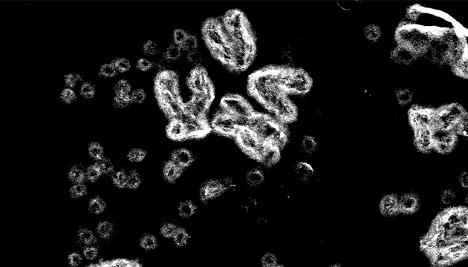 Extracellular DNA circles surrounded by X-shaped chromosomes in an electron micrograph. Image courtesy of Paul Mischel.
